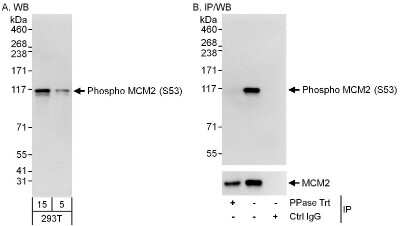 Western Blot: MCM2 [p Ser53] Antibody [NB100-2339]